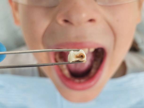 Best Walk-In Emergency Dental Services in Brookfield, MO
